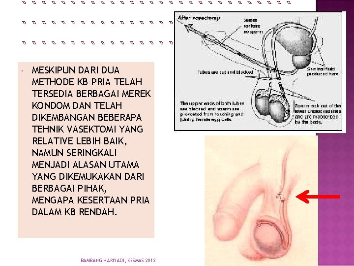  MESKIPUN DARI DUA METHODE KB PRIA TELAH TERSEDIA BERBAGAI MEREK KONDOM DAN TELAH