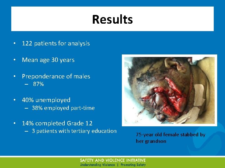 Results • 122 patients for analysis • Mean age 30 years • Preponderance of