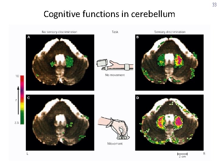 33 Cognitive functions in cerebellum 