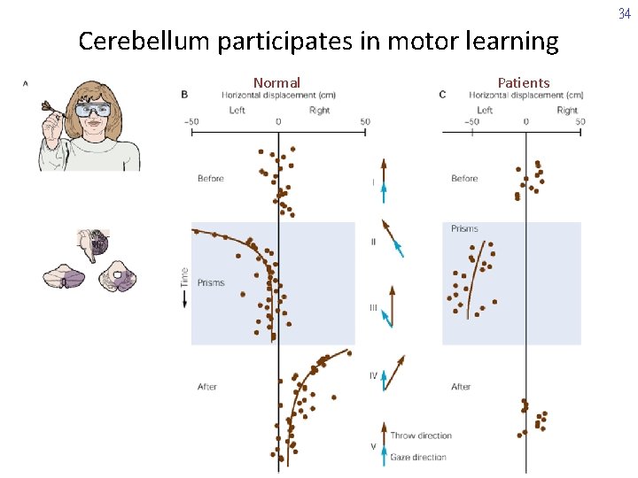 34 Cerebellum participates in motor learning Normal Patients 