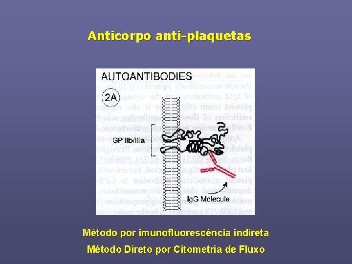 Anticorpo anti-plaquetas Método por imunofluorescência indireta Método Direto por Citometria de Fluxo 