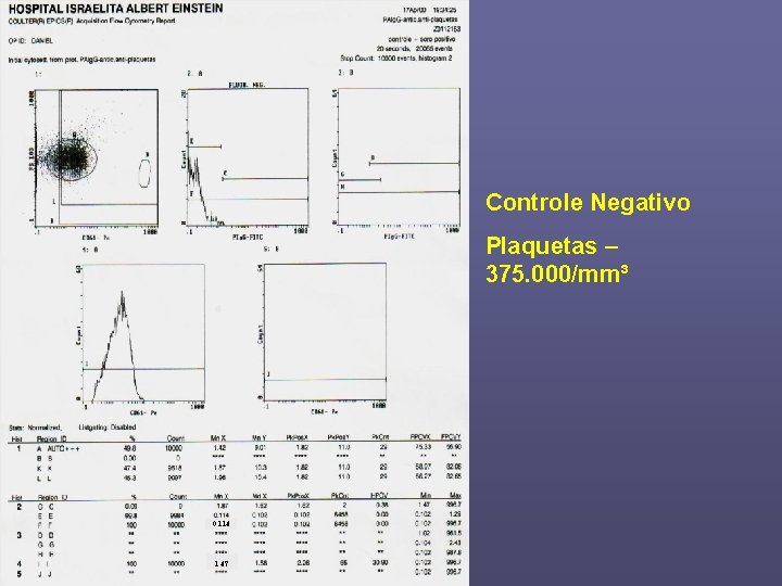 Controle Negativo Plaquetas – 375. 000/mm³ 0. 114 1. 47 