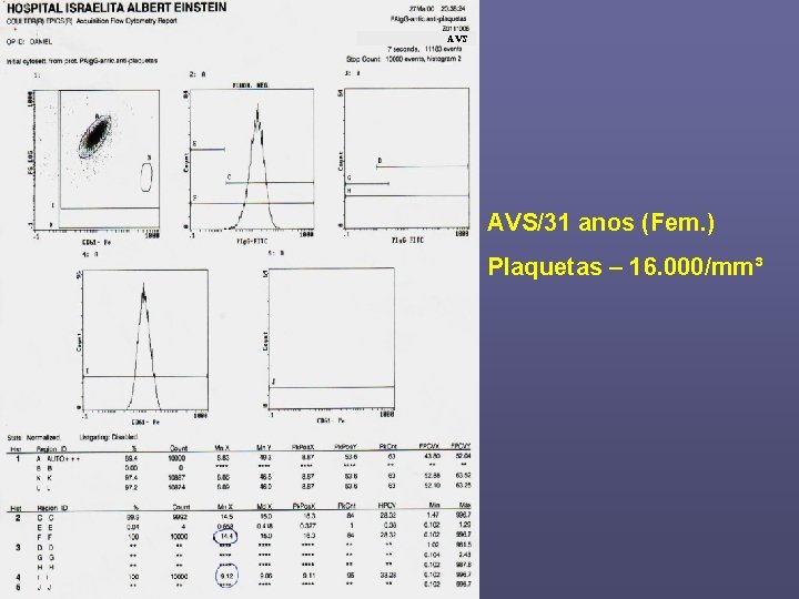 AVS AVS/31 anos (Fem. ) Plaquetas – 16. 000/mm³ 