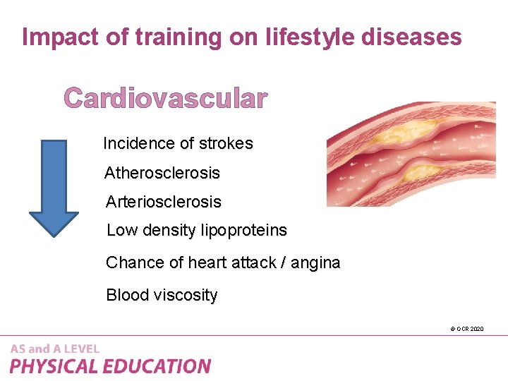 Impact of training on lifestyle diseases Cardiovascular Incidence of strokes Atherosclerosis Arteriosclerosis Low density