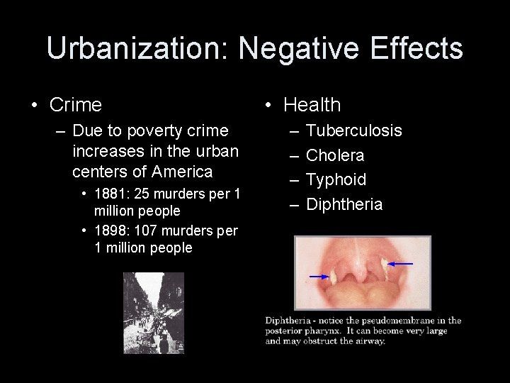 Urbanization: Negative Effects • Crime – Due to poverty crime increases in the urban