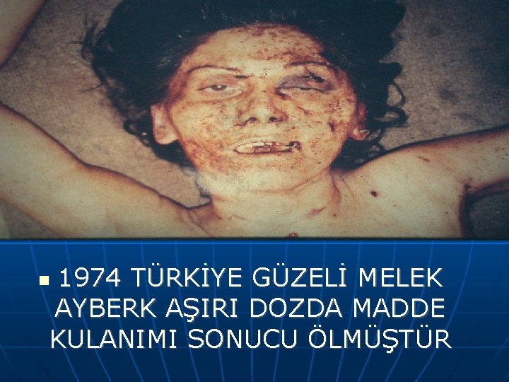 1974 TÜRKİYE GÜZELİ MELEK AYBERK AŞIRI DOZDA MADDE KULANIMI SONUCU ÖLMÜŞTÜR 