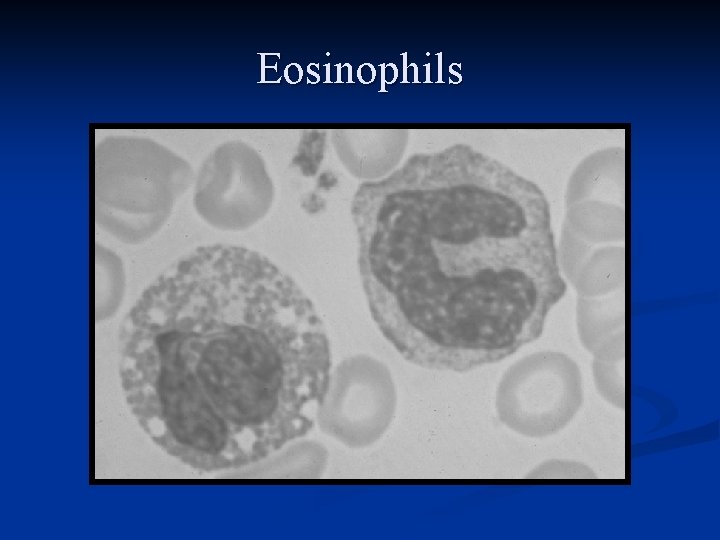 Eosinophils 