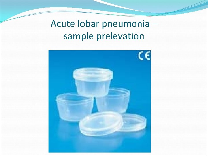 Acute lobar pneumonia – sample prelevation 