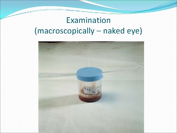 Examination (macroscopically – naked eye) 