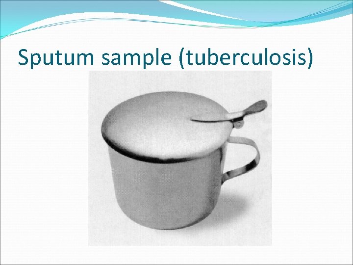 Sputum sample (tuberculosis) 
