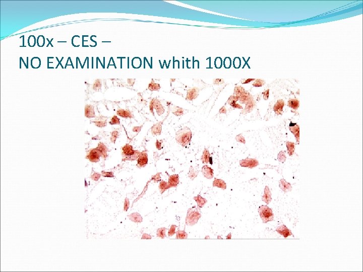 100 x – CES – NO EXAMINATION whith 1000 X 