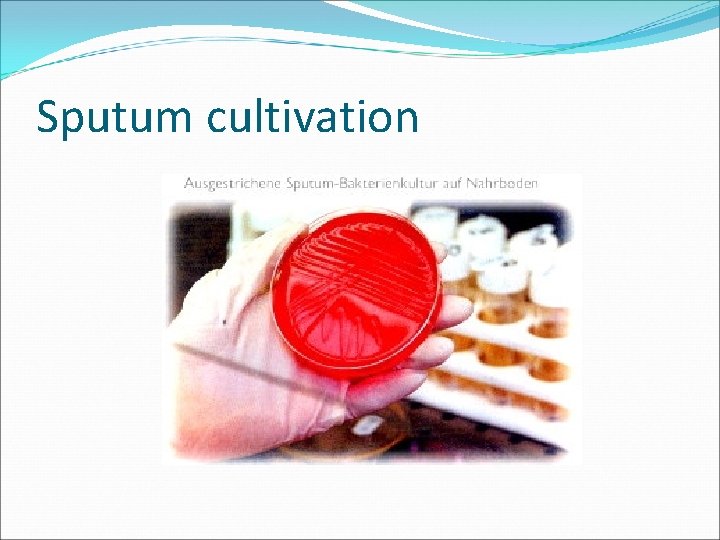 Sputum cultivation 