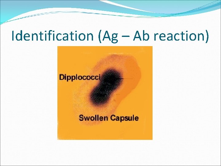 Identification (Ag – Ab reaction) 