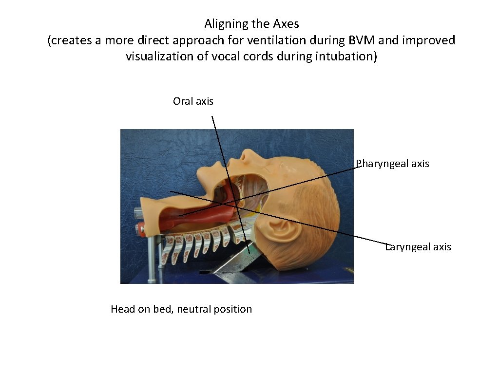 Aligning the Axes (creates a more direct approach for ventilation during BVM and improved