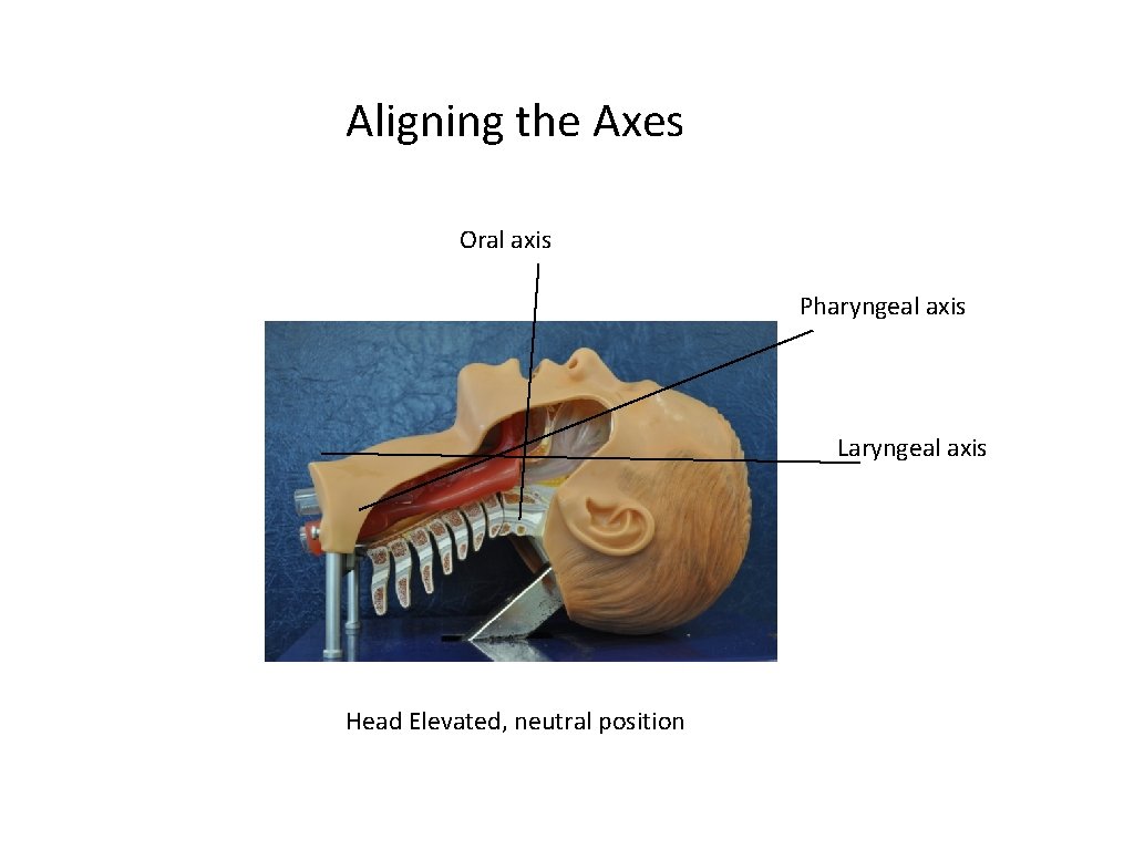 Aligning the Axes Oral axis Pharyngeal axis Laryngeal axis Head Elevated, neutral position 