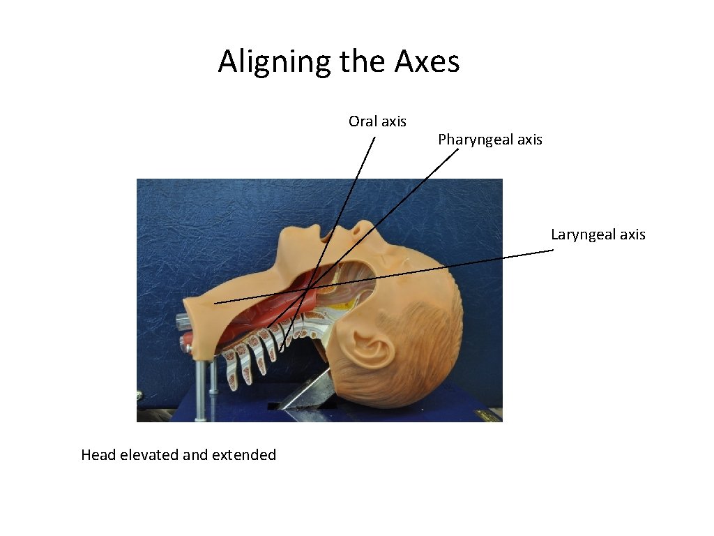 Aligning the Axes Oral axis Pharyngeal axis Laryngeal axis Head elevated and extended 