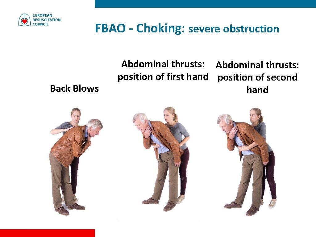 FBAO - Choking: severe obstruction Back Blows Abdominal thrusts: position of first hand position