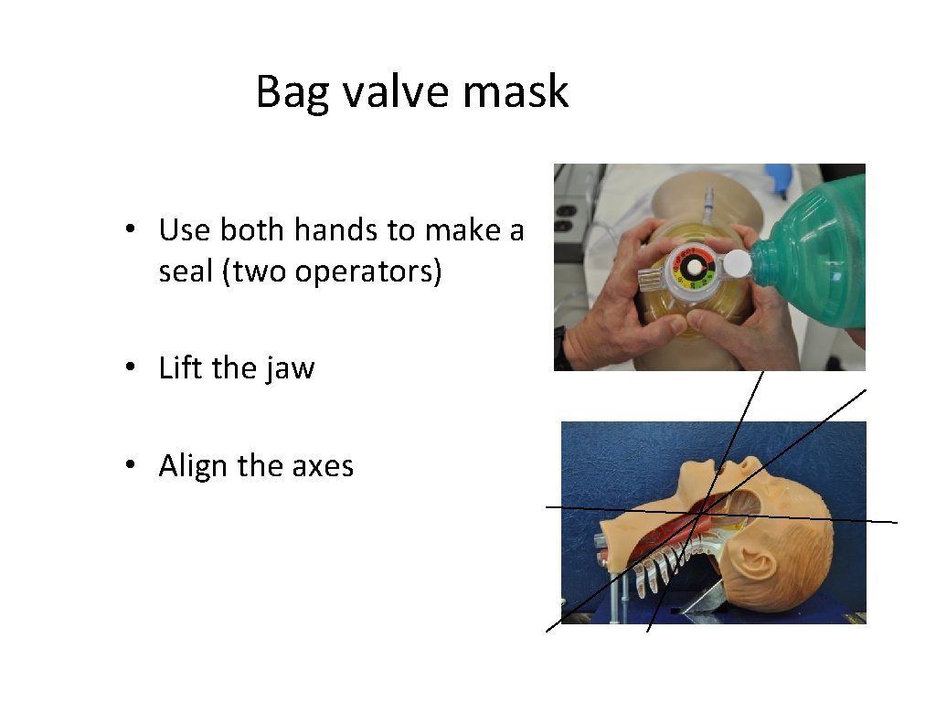 Bag valve mask • Use both hands to make a seal (two operators) •