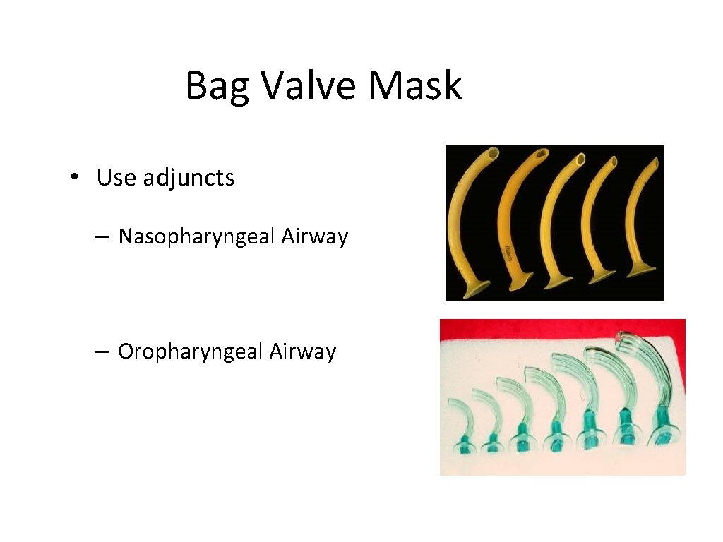 Bag Valve Mask • Use adjuncts – Nasopharyngeal Airway – Oropharyngeal Airway 