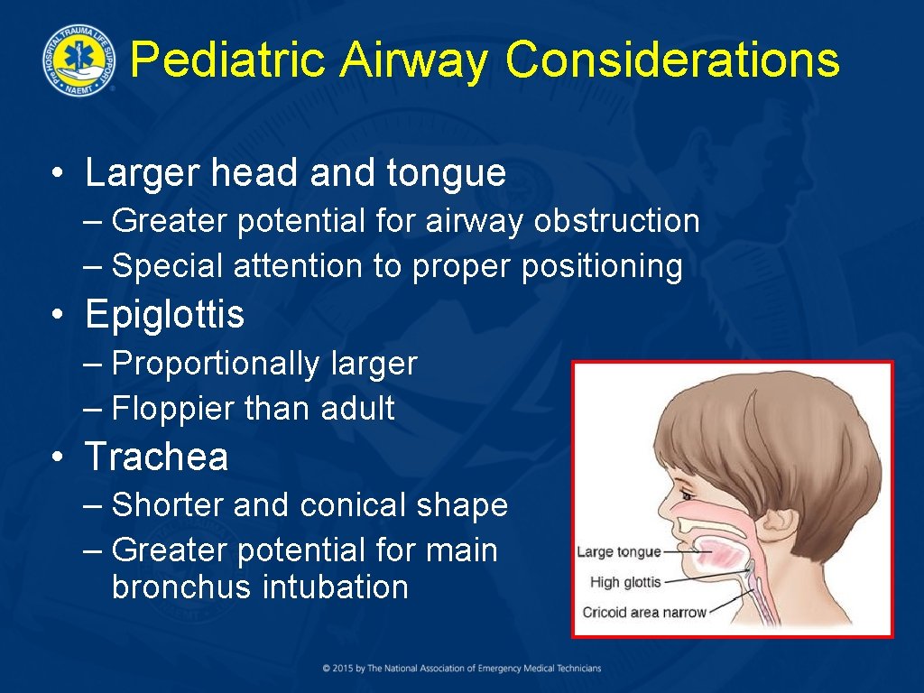 Pediatric Airway Considerations • Larger head and tongue – Greater potential for airway obstruction