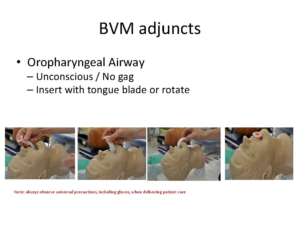 BVM adjuncts • Oropharyngeal Airway – Unconscious / No gag – Insert with tongue