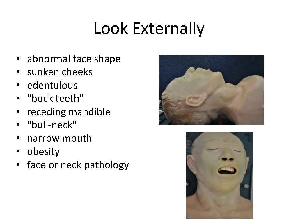 Look Externally • • • abnormal face shape sunken cheeks edentulous "buck teeth" receding