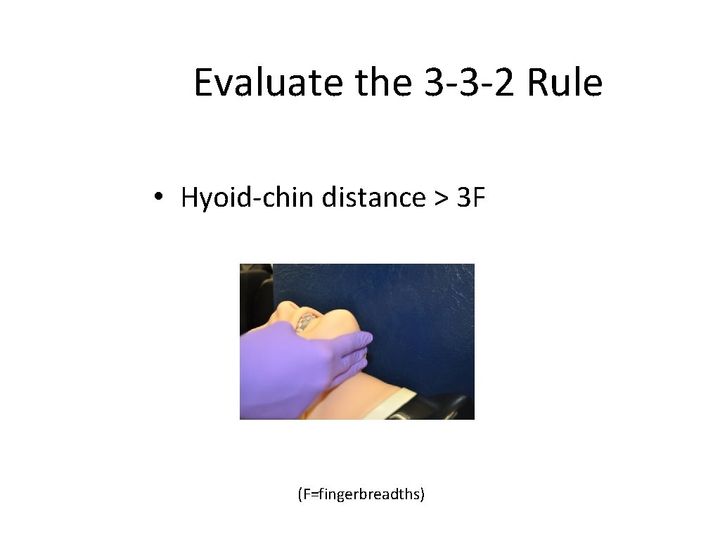 Evaluate the 3 -3 -2 Rule • Hyoid-chin distance > 3 F (F=fingerbreadths) 