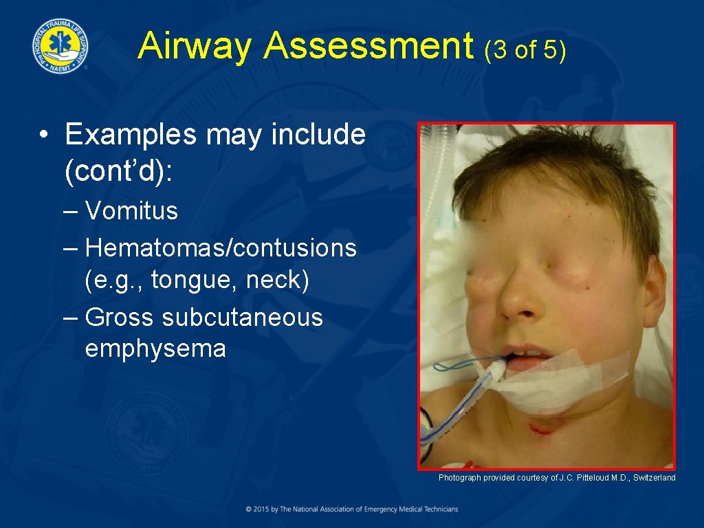 Airway Assessment (3 of 5) • Examples may include (cont’d): – Vomitus – Hematomas/contusions