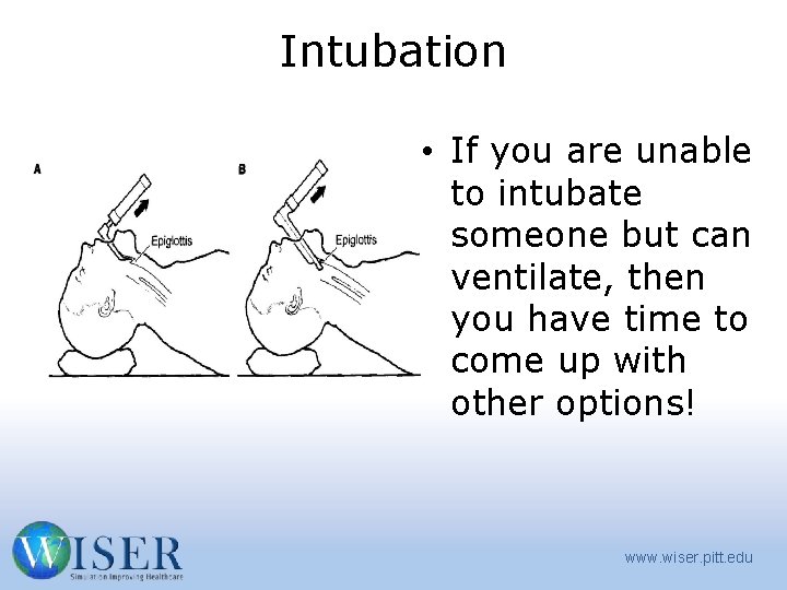 Intubation • If you are unable to intubate someone but can ventilate, then you