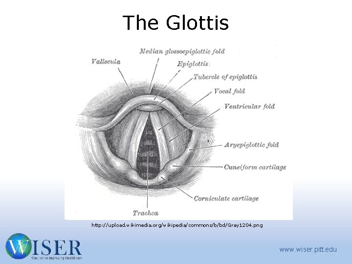 The Glottis http: //upload. wikimedia. org/wikipedia/commons/b/bd/Gray 1204. png www. wiser. pitt. edu 