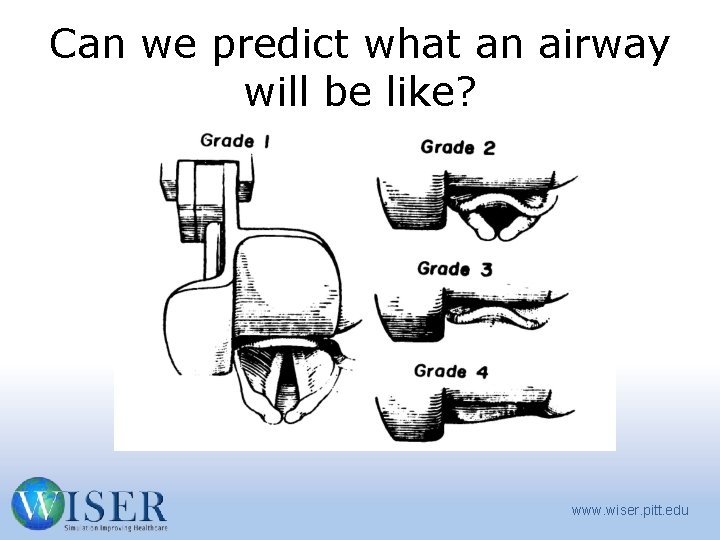 Can we predict what an airway will be like? www. wiser. pitt. edu 