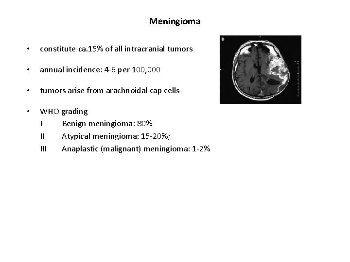 Meningioma • constitute ca. 15% of all intracranial tumors • annual incidence: 4 -6