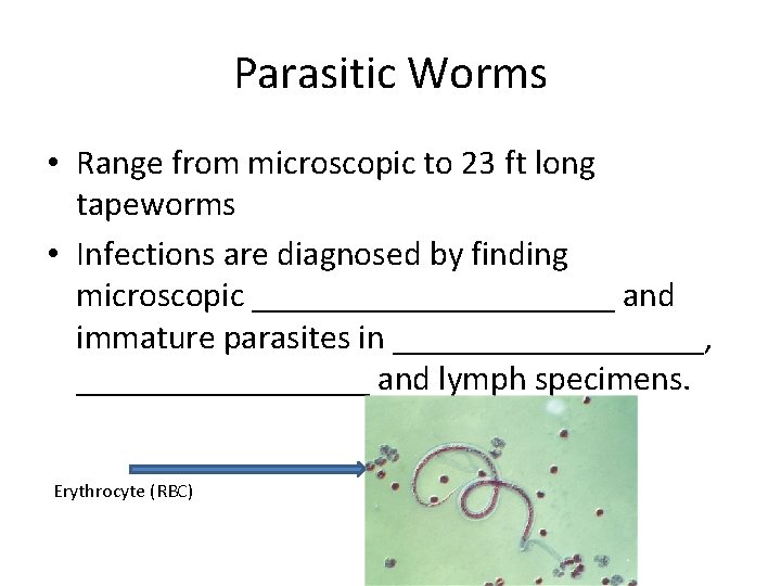 Parasitic Worms • Range from microscopic to 23 ft long tapeworms • Infections are
