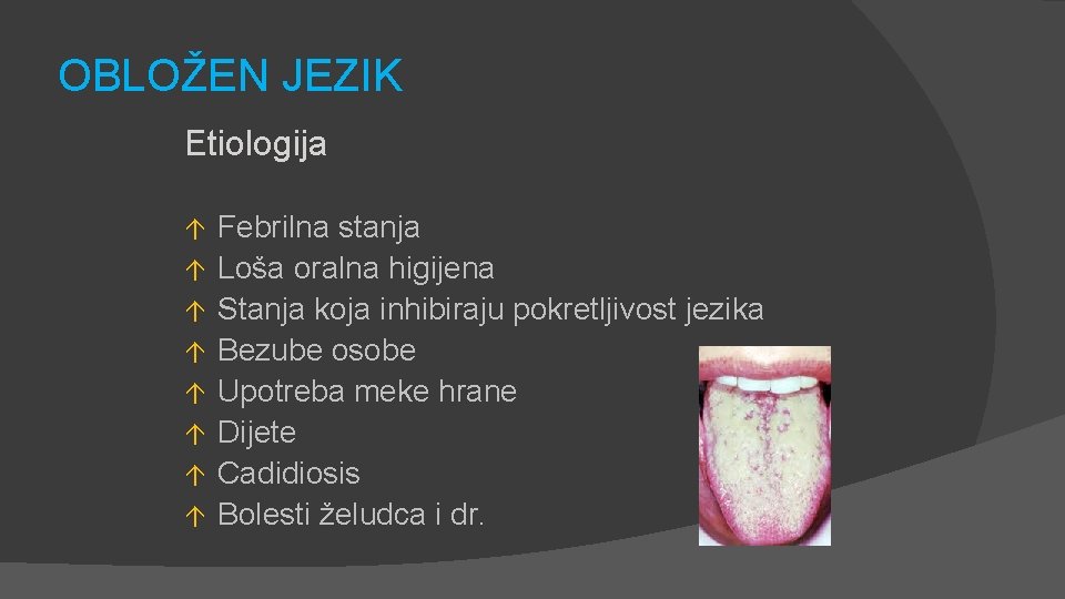 OBLOŽEN JEZIK Etiologija á á á á Febrilna stanja Loša oralna higijena Stanja koja