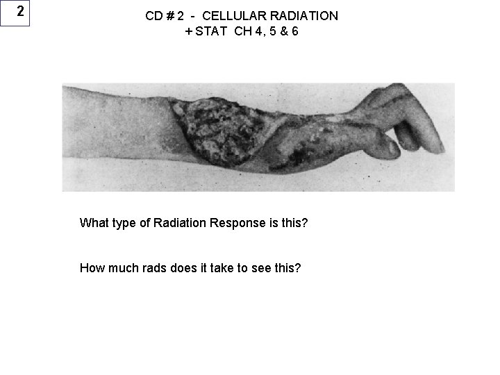 2 CD # 2 - CELLULAR RADIATION + STAT CH 4, 5 & 6