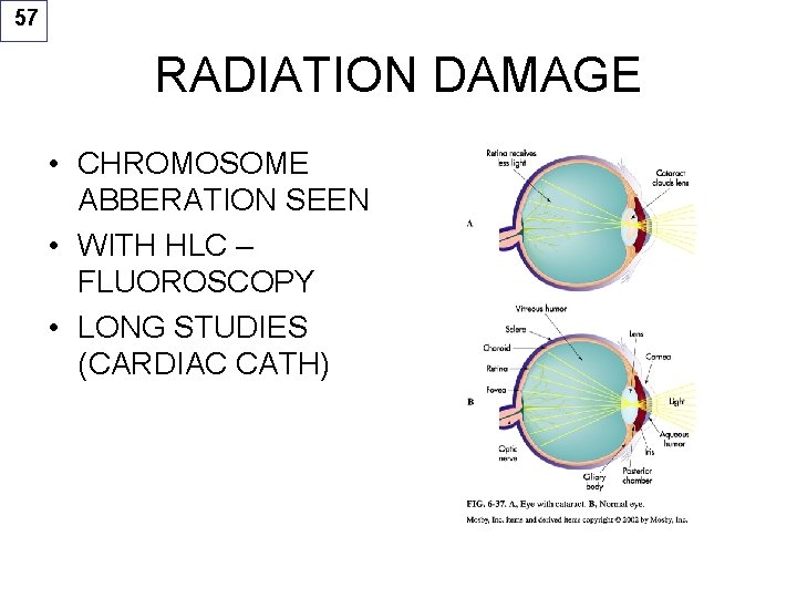 57 RADIATION DAMAGE • CHROMOSOME ABBERATION SEEN • WITH HLC – FLUOROSCOPY • LONG