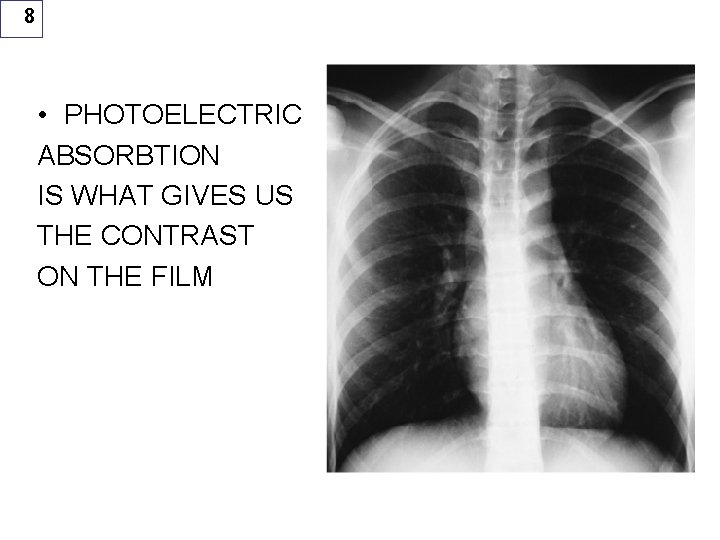 8 • PHOTOELECTRIC ABSORBTION IS WHAT GIVES US THE CONTRAST ON THE FILM 