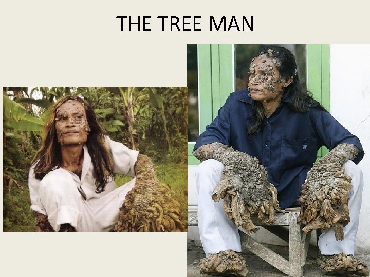 THE TREE MAN 
