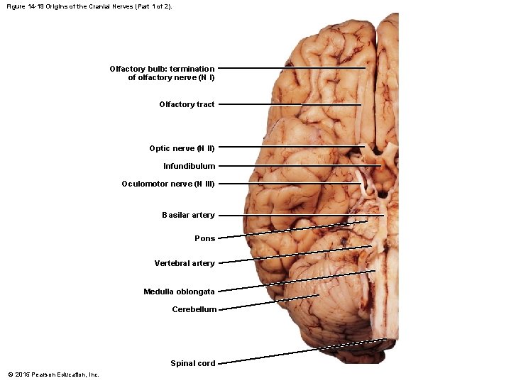 Figure 14 -19 Origins of the Cranial Nerves (Part 1 of 2). Olfactory bulb: Figure 14 -19 Origins of the Cranial Nerves (Part 1 of 2). Olfactory bulb: