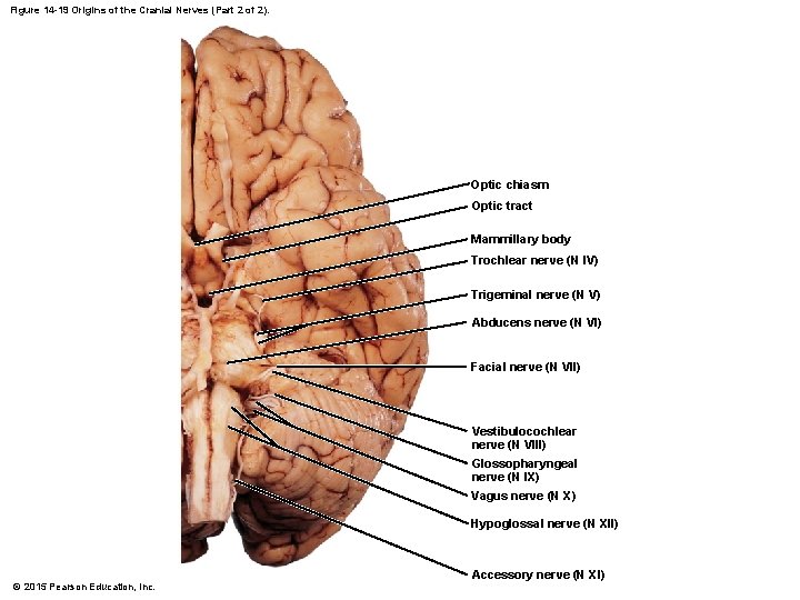 Figure 14 -19 Origins of the Cranial Nerves (Part 2 of 2). Optic chiasm Figure 14 -19 Origins of the Cranial Nerves (Part 2 of 2). Optic chiasm