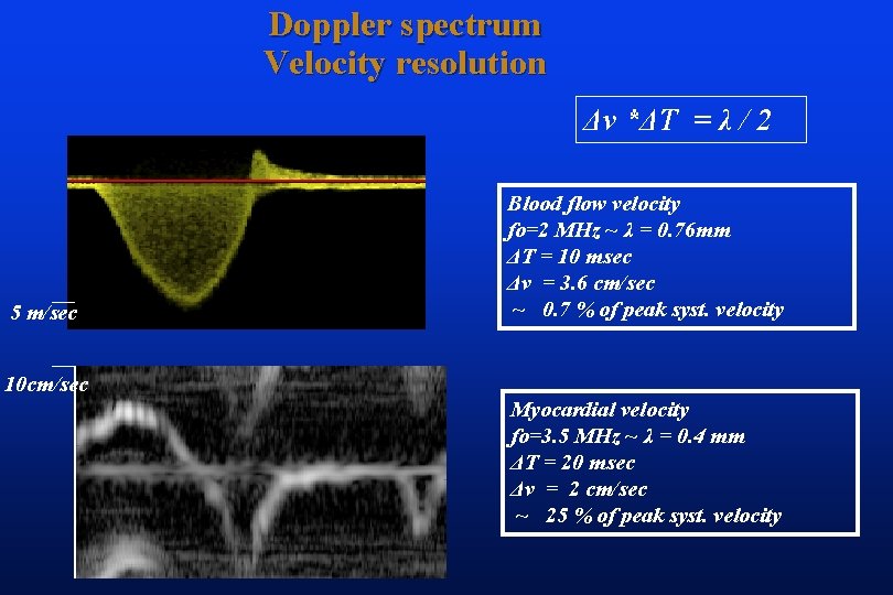 Doppler spectrum Velocity resolution Δv *ΔT = λ / 2 5 m/sec Blood flow