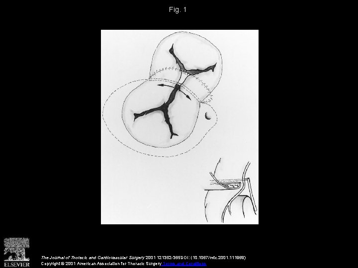 Fig. 1 The Journal of Thoracic and Cardiovascular Surgery 2001 121352 -365 DOI: (10.