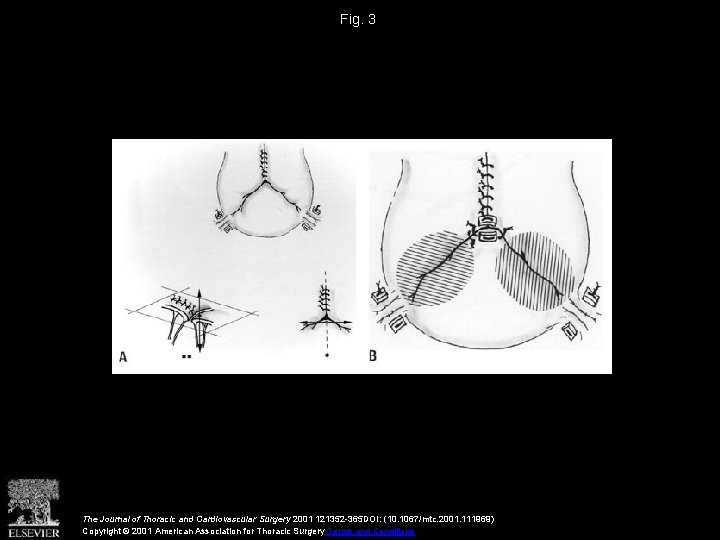 Fig. 3 The Journal of Thoracic and Cardiovascular Surgery 2001 121352 -365 DOI: (10.