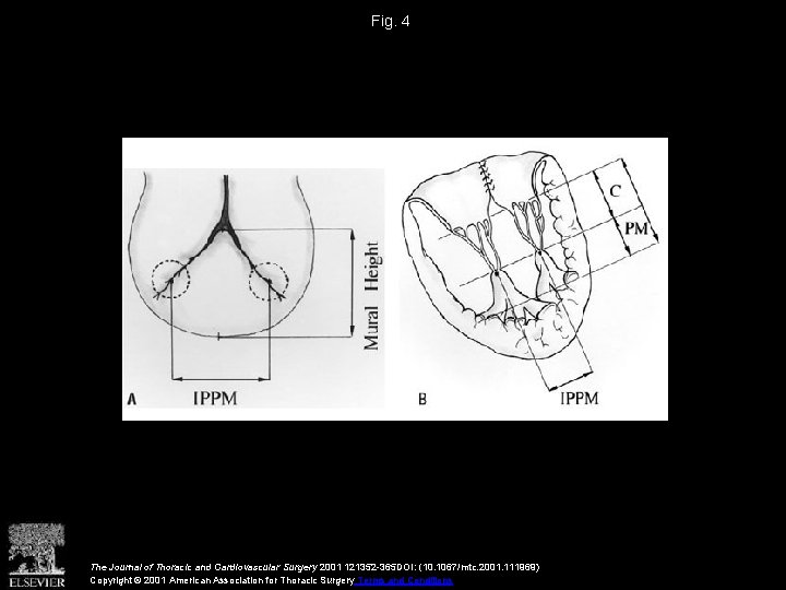 Fig. 4 The Journal of Thoracic and Cardiovascular Surgery 2001 121352 -365 DOI: (10.