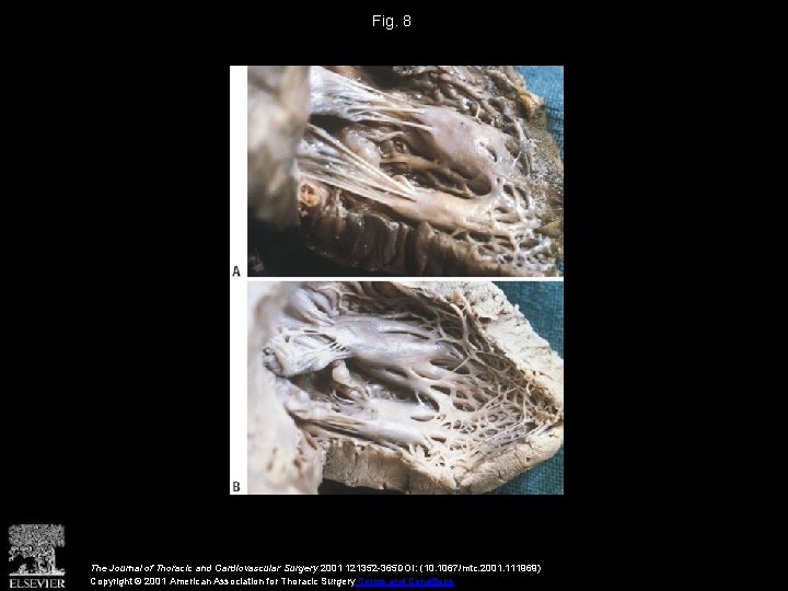 Fig. 8 The Journal of Thoracic and Cardiovascular Surgery 2001 121352 -365 DOI: (10.