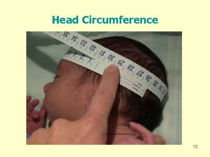 Head Circumference 12 