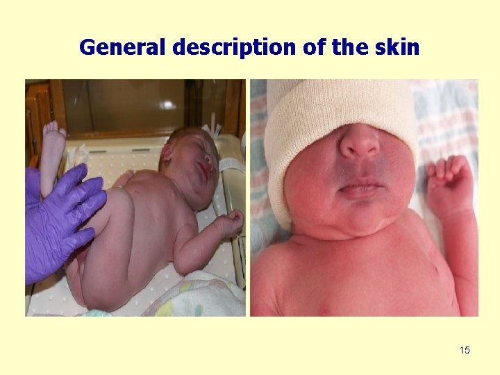 General description of the skin 15 