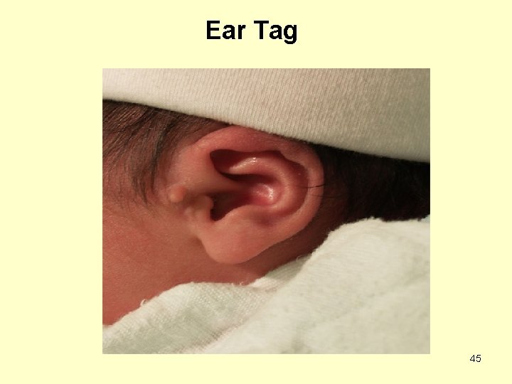 Ear Tag 45 