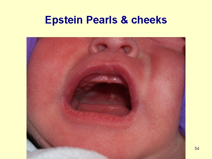 Epstein Pearls & cheeks 54 