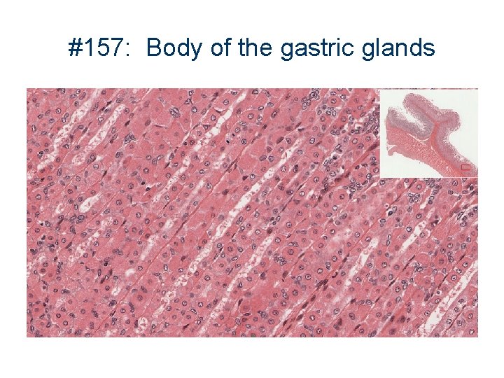#157: Body of the gastric glands 